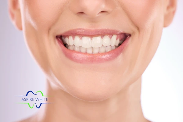 Follow your teeth whitening aftercare Derby to prolong your whiter smile!